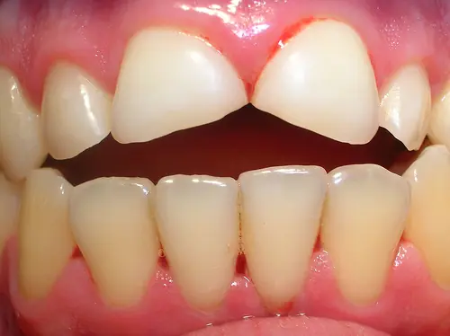 dental