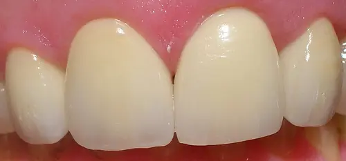 porcelana