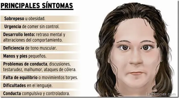 9 Enfermedades Raras