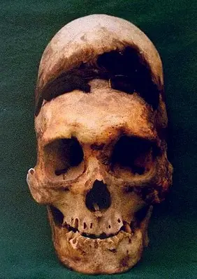 albertocanosa