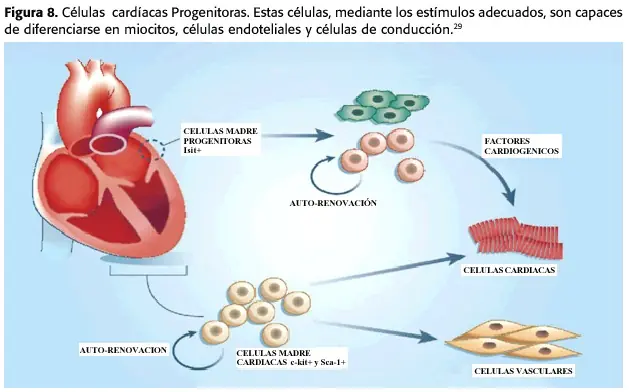 corazon