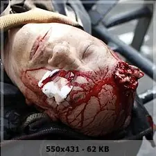 uso de casco