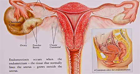 mujeres