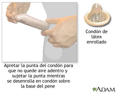 Anticoncepcion (con graficos)