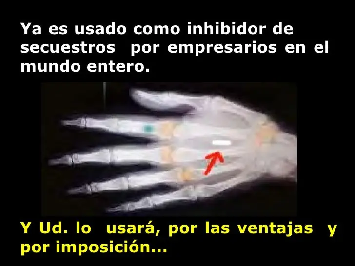 Verichip: ¿Avance de la ciencia o algo mas?
