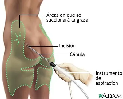 ayuda