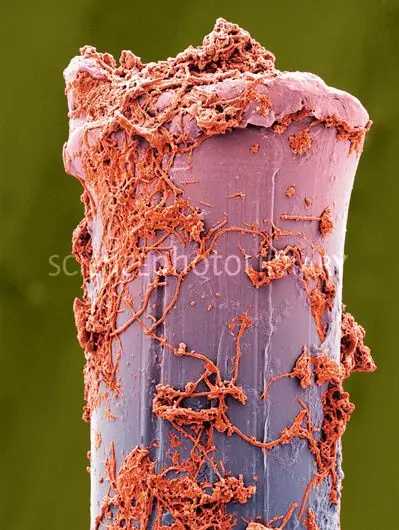 microscopio