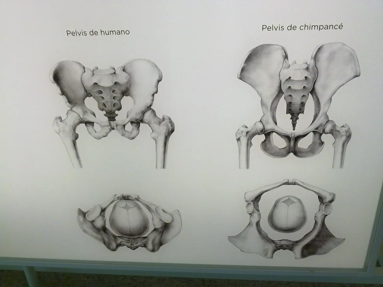 caderas
