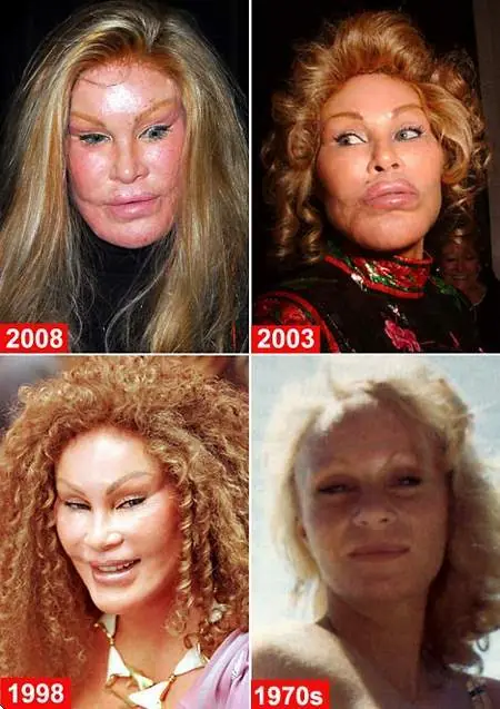Jocelyn Wildenstein otra especie de gato... y loca mental.