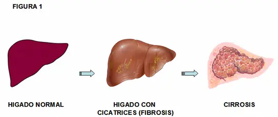 gripe