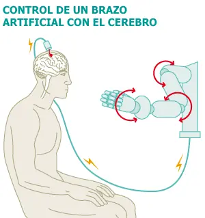 Personas paralizadas consiguen mover un brazo con el cerebro