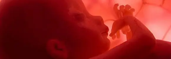 El derecho a vivir. No al aborto