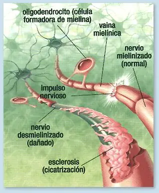de