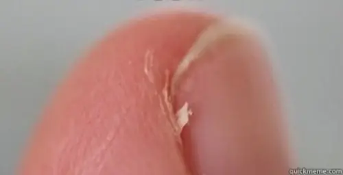 Cosas que sacan de quicio