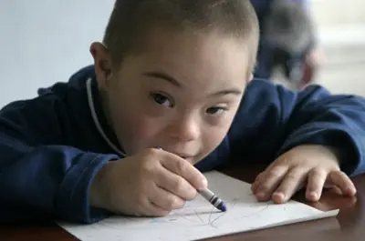 los que tienen sindrome de down simplemente no pueden