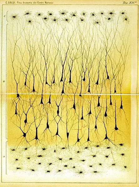 neurología