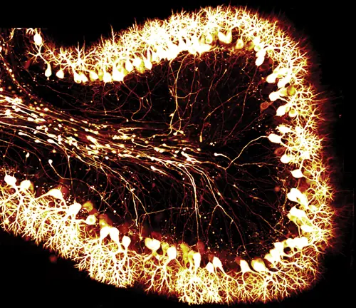 neurología