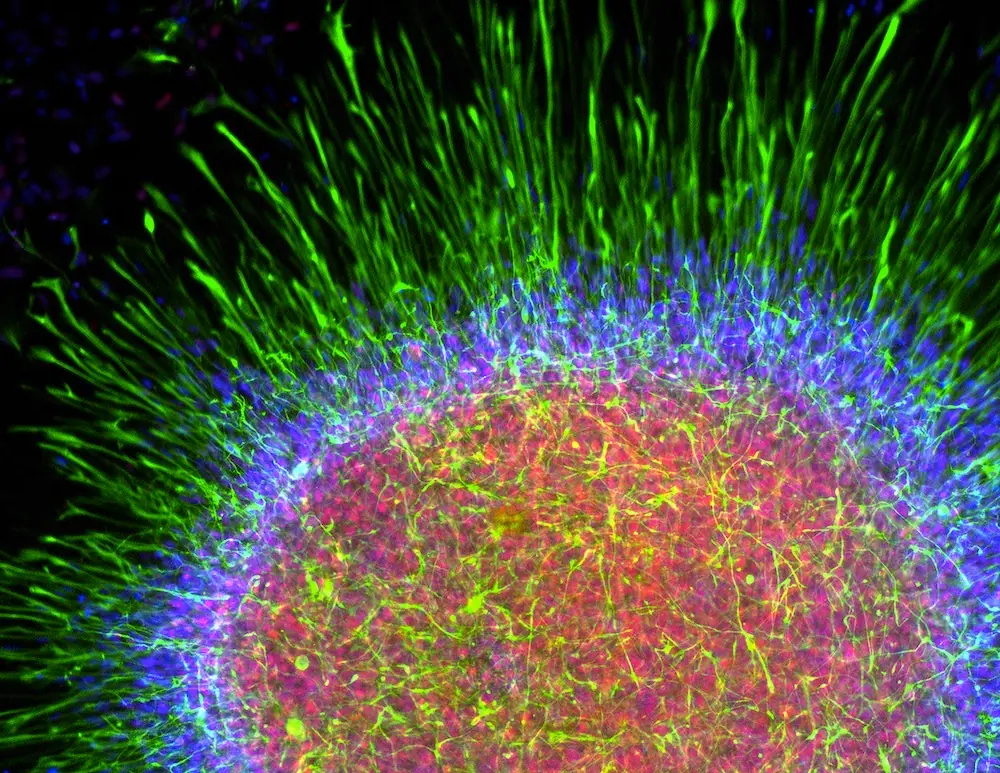 El cerebro se parece a todas las cosas del universo