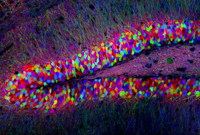 cerebro