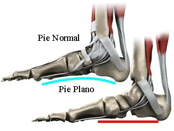pies
