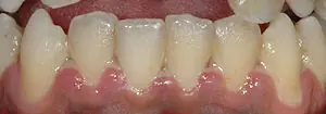 Hilo dental
