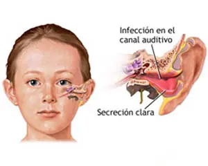 Remedios Caseros - FuncionaN (parte 3)