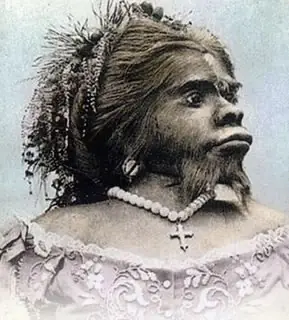 Se descifra el misterio de la mujer barbuda