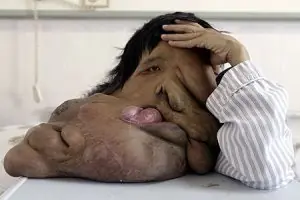 enfermedad