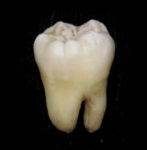 La Dentadura humana! A cuidarla!