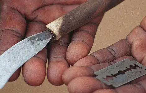 mutilación genital femenina (fuerte)