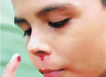 dolor de muelas