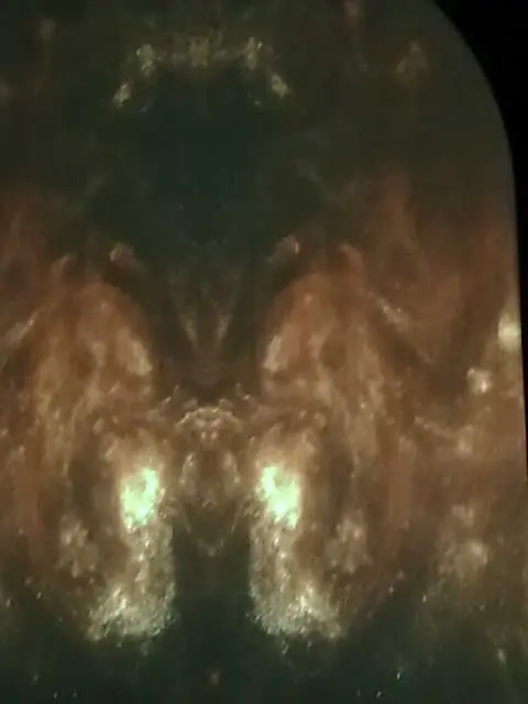 taringa