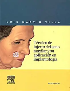 gratis