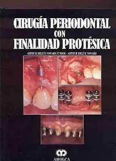 gratis