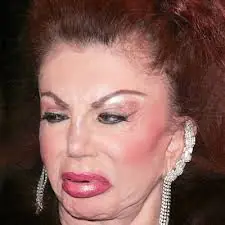 Eviten las cirugias plasticas..hahahaha+..entren y vean esto