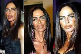 Eviten las cirugias plasticas..hahahaha+..entren y vean esto