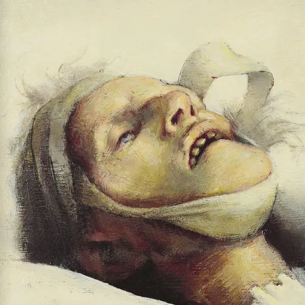 lenkiewicz