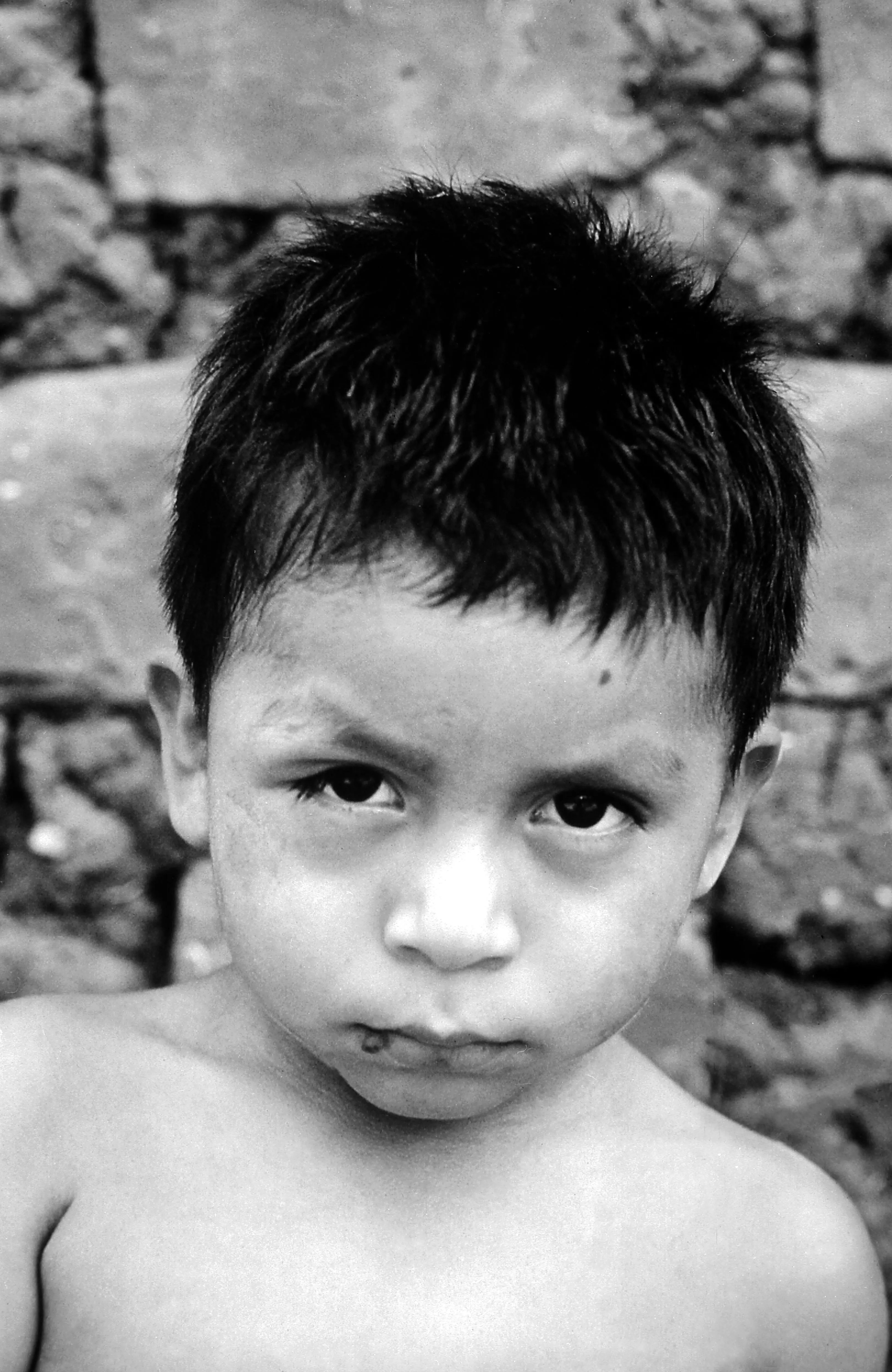 enfermedad de chagas