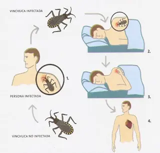 enfermedad de chagas