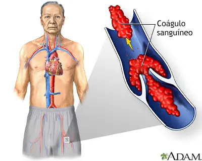 diagnostico