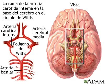 accidente