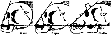 craneo