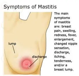Mamás Afectadas por la Mastitis