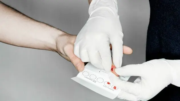¿Cuánto te queda de vida? Una gota de sangre y se sabe