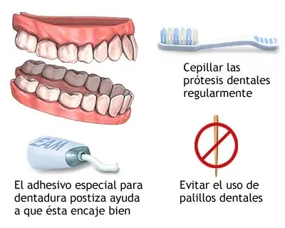 imporante