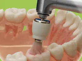 ¿Sabias ésto sobre los dientes?