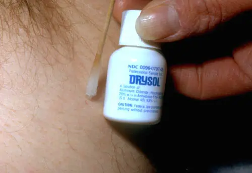 sudor excesivo