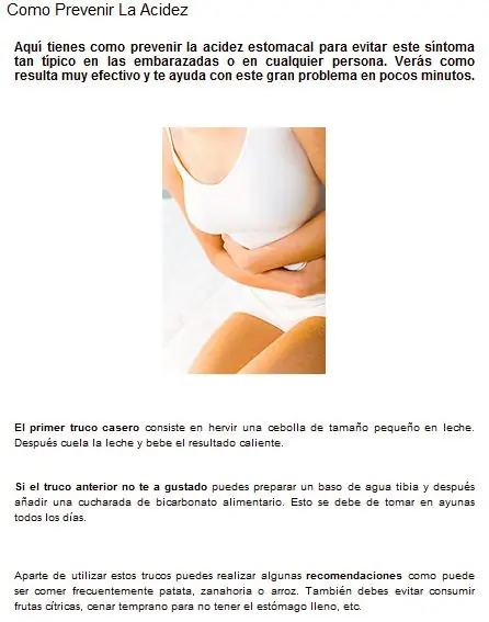 Trucos