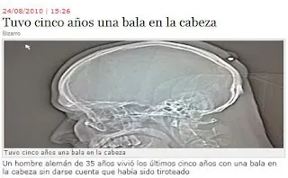 Bala perdida encuentra a un boludo en Alemania