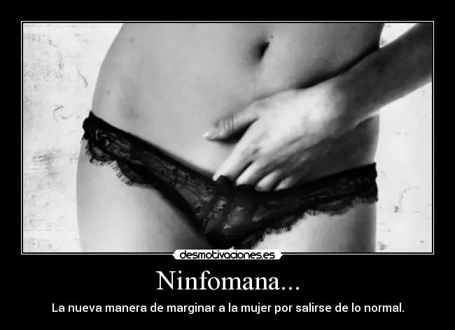 Algunas definiciones; Dejame un puntooo.